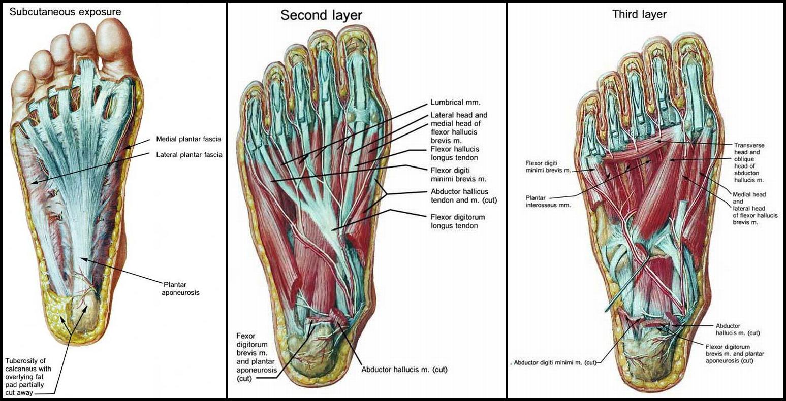 Mortons Neuroma Solution Helene Ori