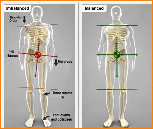 Skeletal imbalances