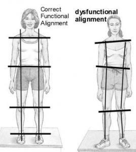 dysfunctional-vs-functional alignment for injury prevention